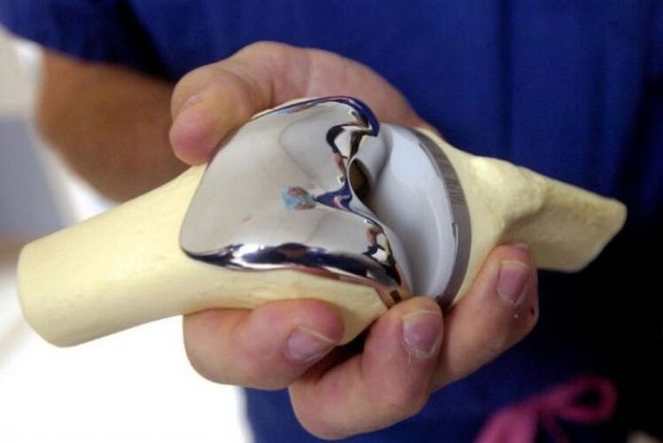 arthrosis endoprosthesis