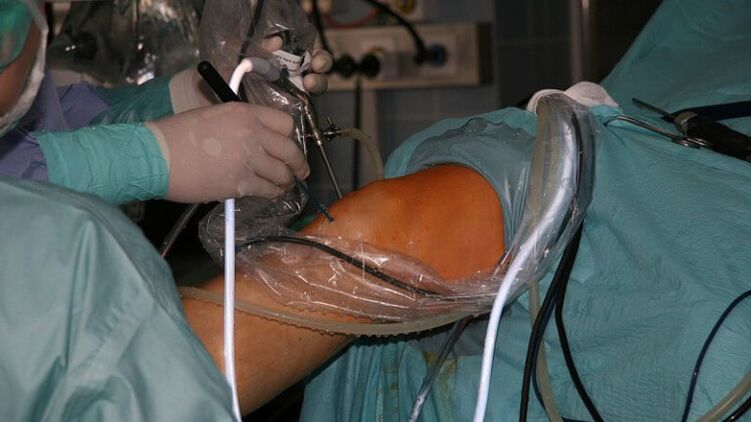 surgical treatment of arthrosis