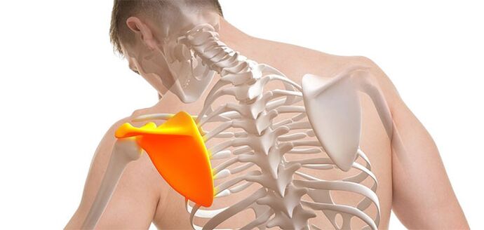 Back pain in the area of ​​the scapula
