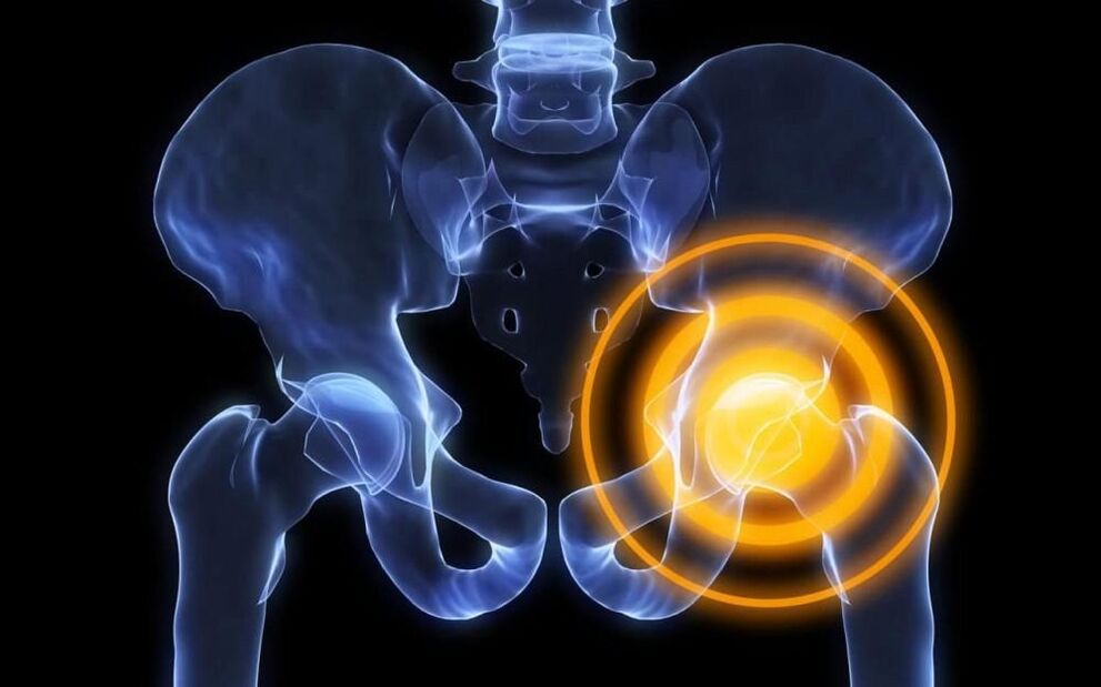 pain in the hip joint picture 2