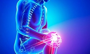 stages of arthrosis of the knee joint