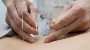 acupuncture for lumbar osteochondrosis