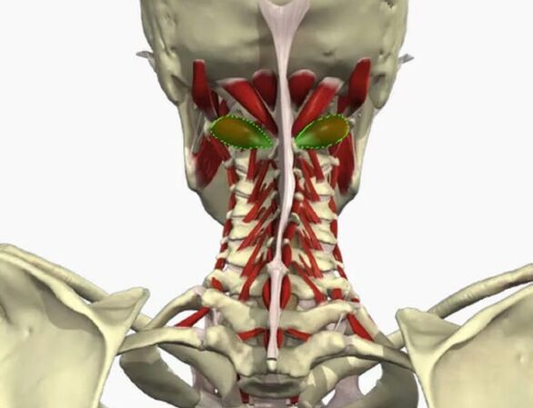 Vertebral artery syndrome