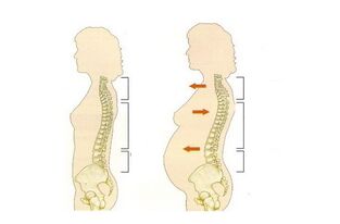 what can provoke low back pain